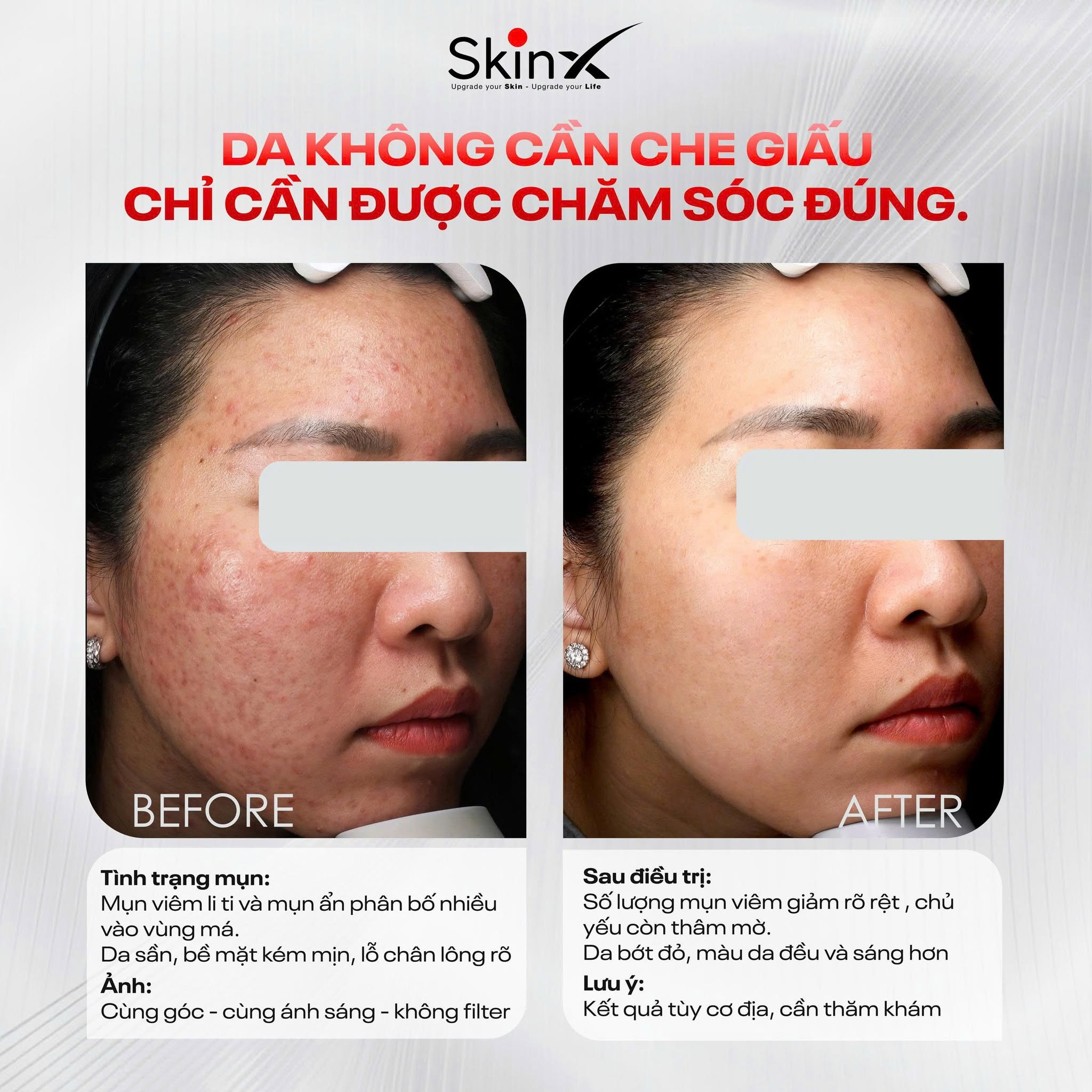 Xem Ảnh Lớn