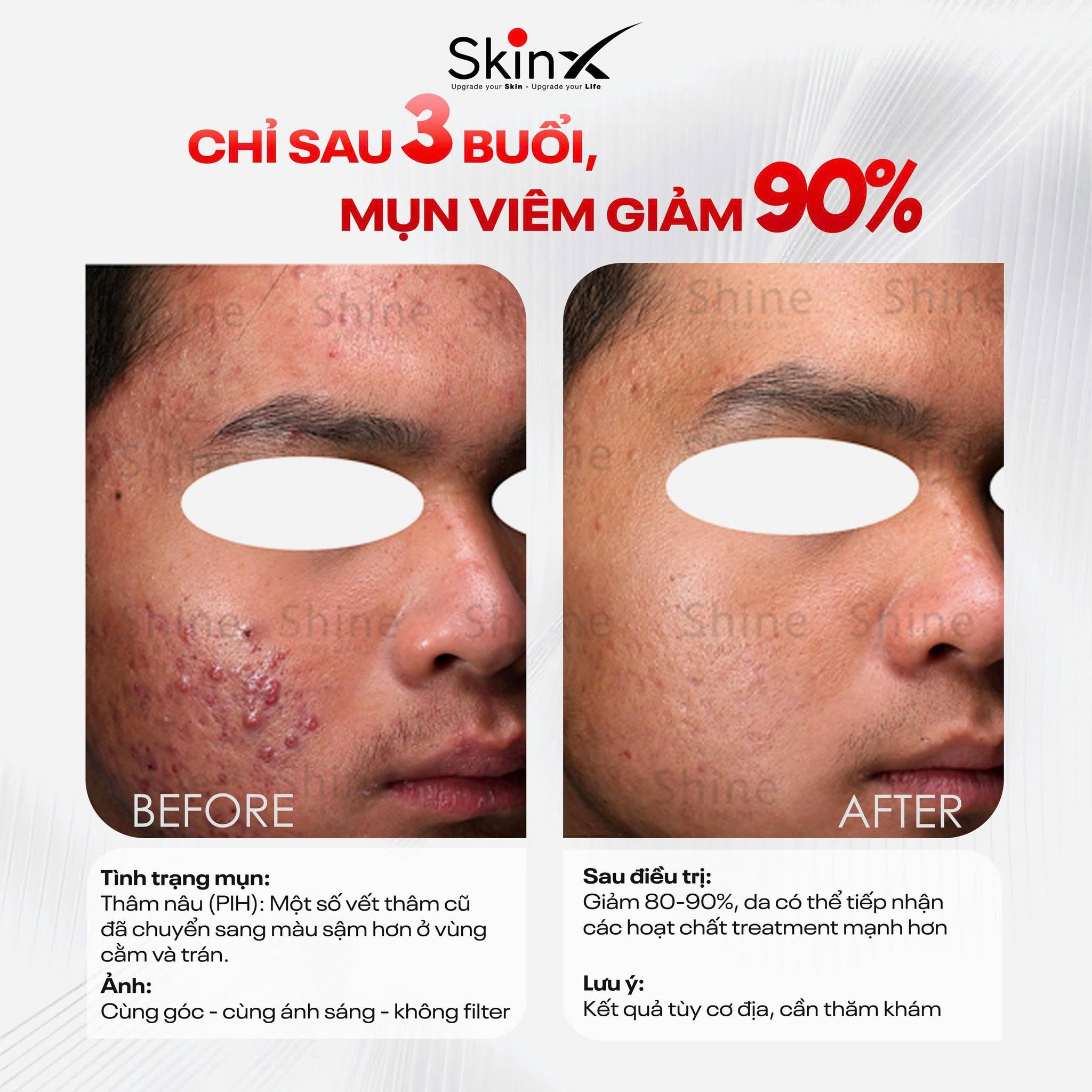 Xem Ảnh Lớn