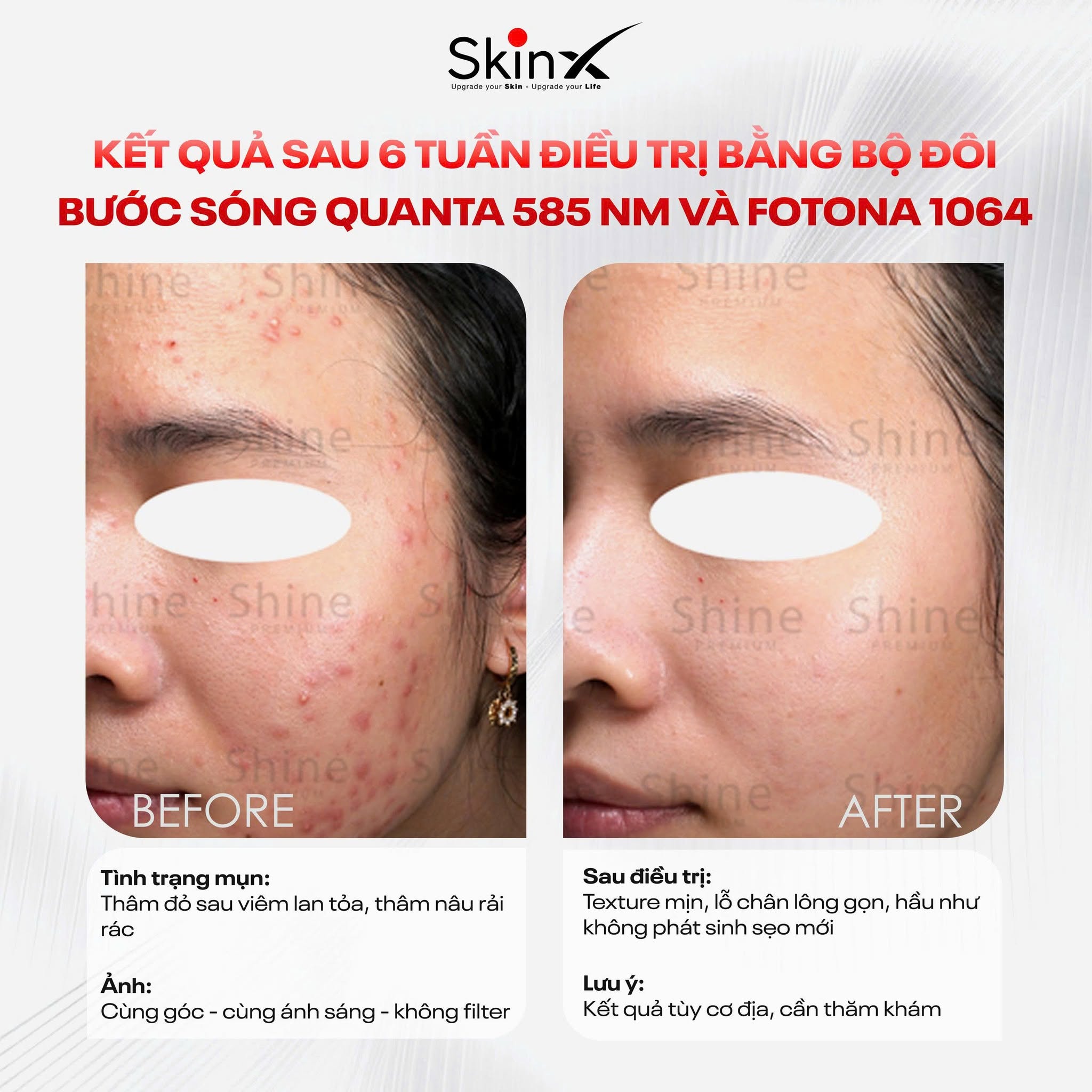 Xem Ảnh Lớn