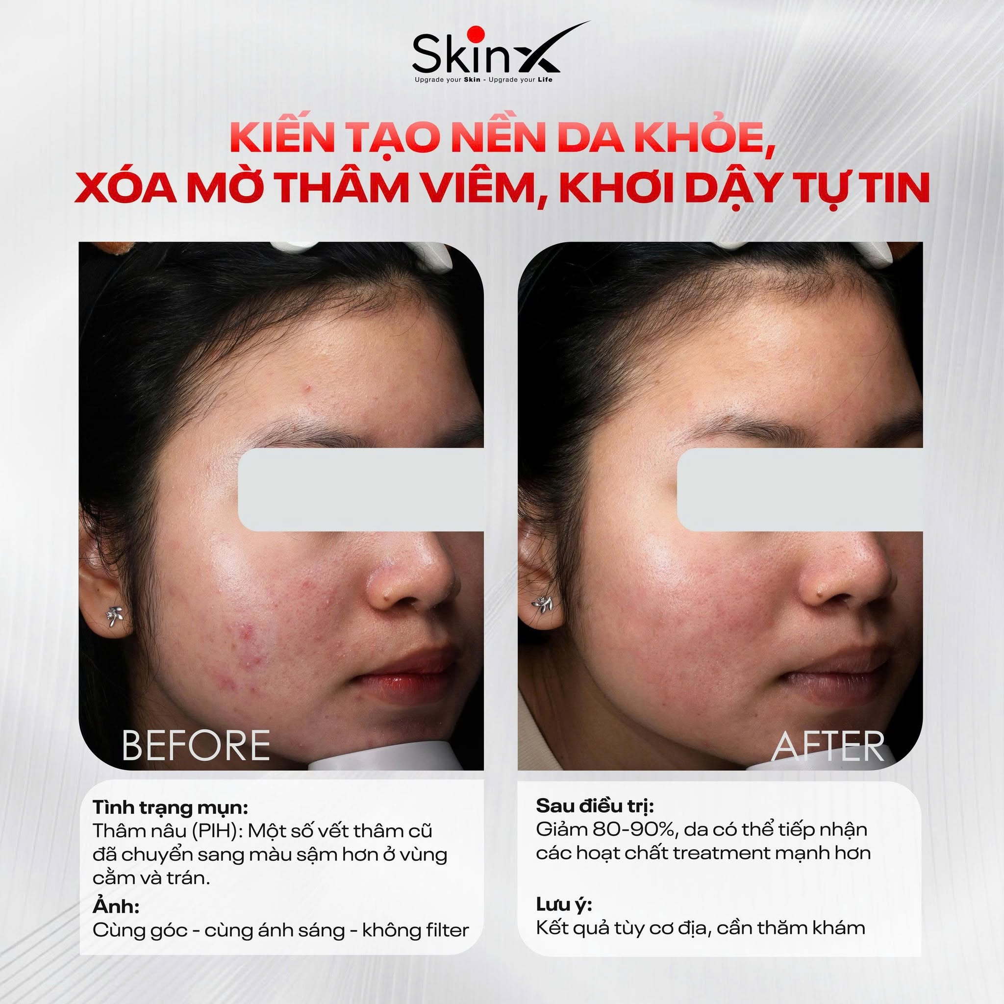 Xem Ảnh Lớn