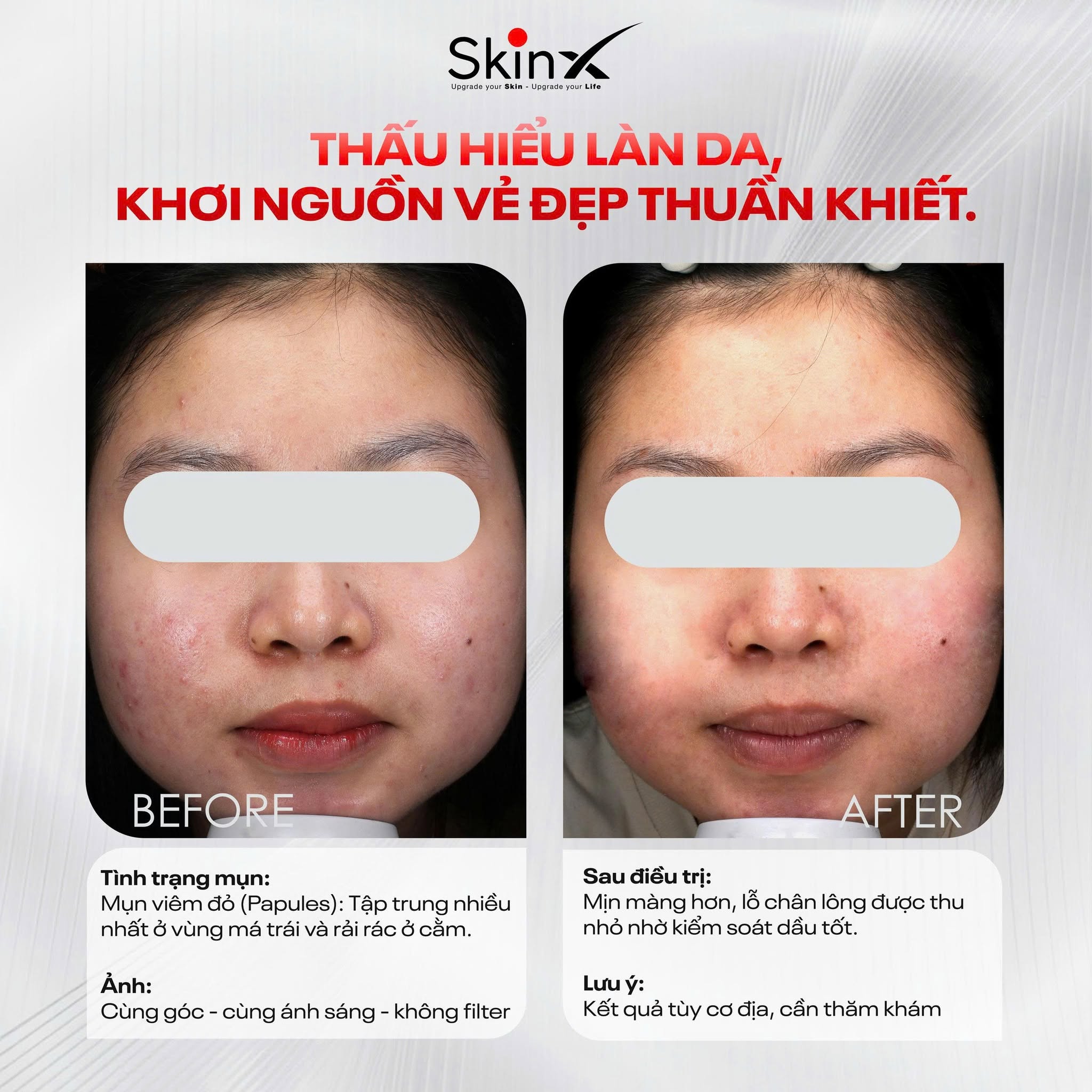 Xem Ảnh Lớn