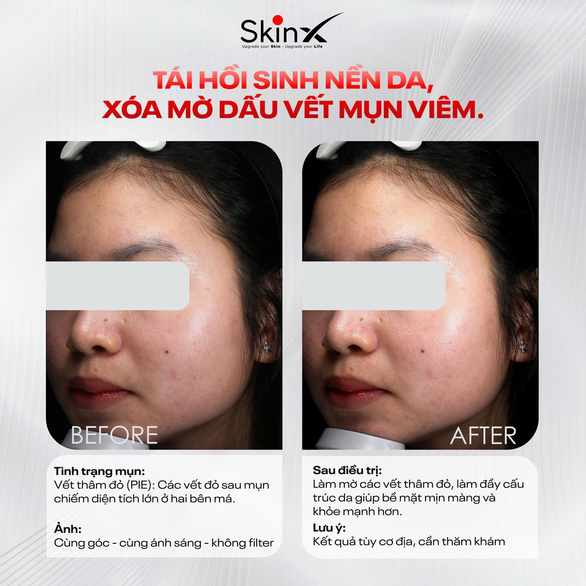 Xem Ảnh Lớn